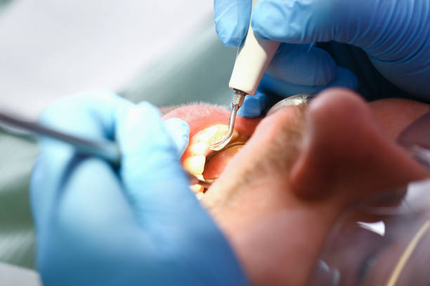 Best Broken or Chipped Tooth Repair in Churubusco, IN